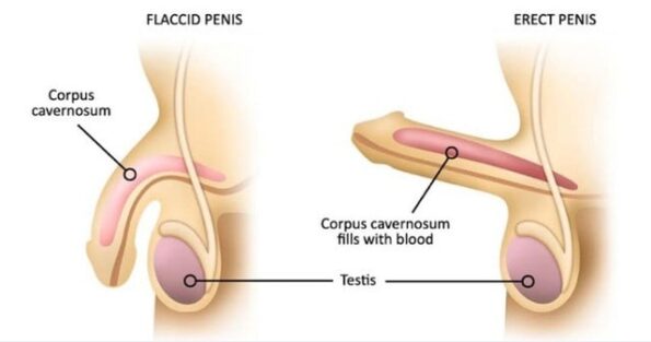 Erectile Dysfunction