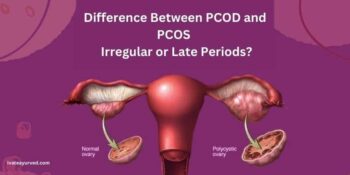 Difference Between PCOD and PCOS